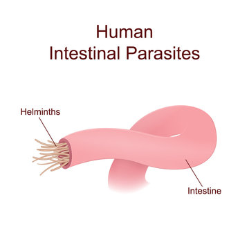 Illustration of internal human parasites