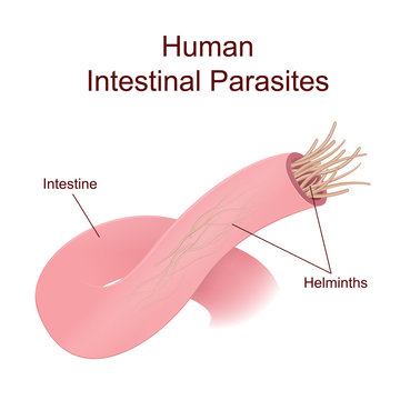 Illustration of internal human parasites