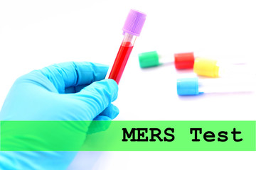 Blood for MERS virus test