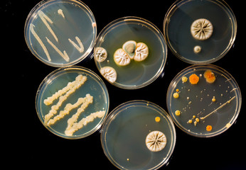 petri dish