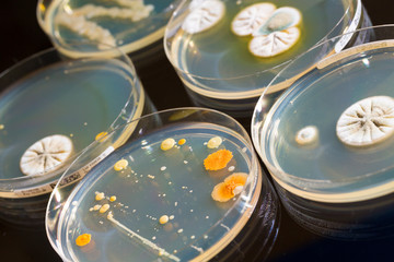 petri dish