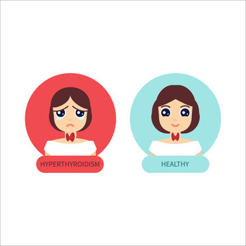 Woman with hyperthyroid gland and healthy woman. Hyperthyroism symbol. Thyroid diagram sign. Medical concept. Anatomy of people. Vector illustration made in cartoon style.