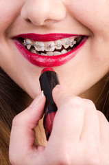 Mouth with brackets and red lipstick