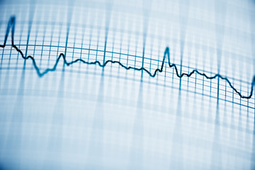 Electrocardiogram