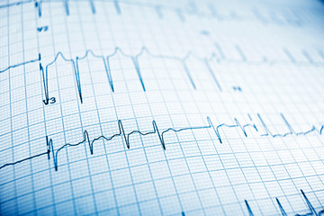Electrocardiogram