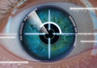 Augen Lasern
