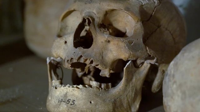This Close-Up of a Skull. Many do Not Have the Teeth in Place