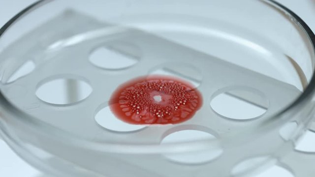 Violent chemical reaction with blood in petri dish