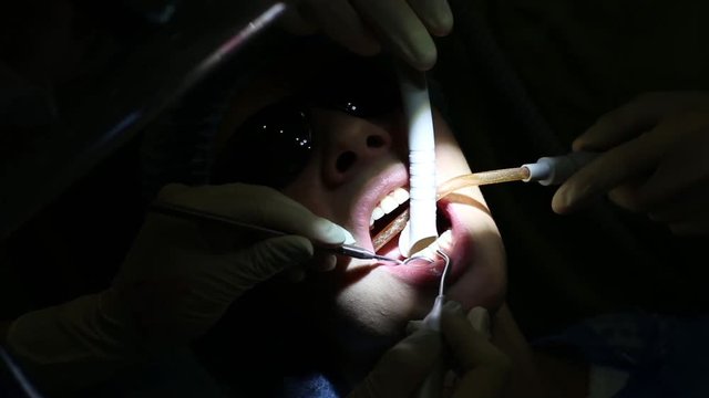 The dentist treats teeth girl