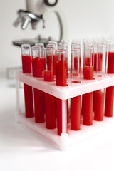 blood in glass tubes on background of microscope