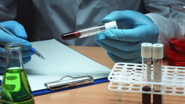 Close up of doctor in blue gloves view blood sample in vacuum tube and write blood test results