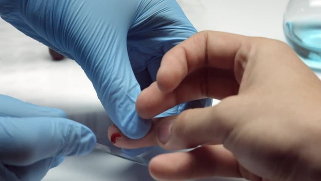 Drop blood from finger on microscope glass slide