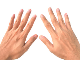 Stretch hand, finger, counting ten with swelling joint finger is
