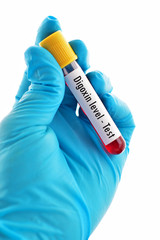 Obraz premium Blood sample for digoxin (drug for heart disease) level test 