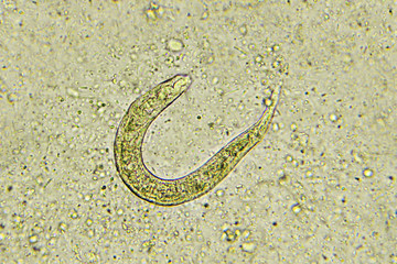 Strongyloides stercoralis (threadworm) in stool, analyze by microscope
