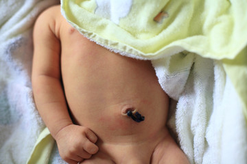 umbilical cord of newborn baby
