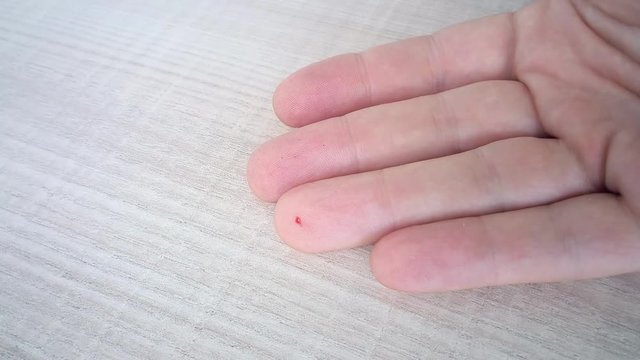 Self testing of blood for sugar