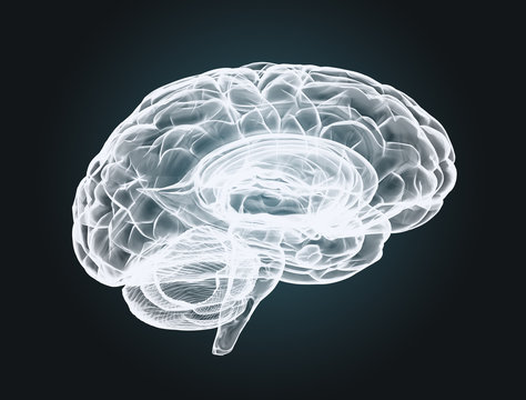 Brain scan  X-ray on black background 