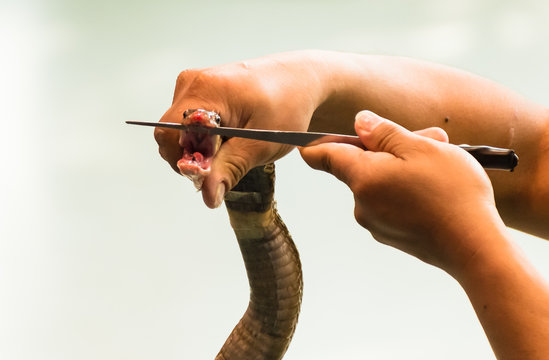 Cobra Venom Extraction By Bare Hands And Knife, Close Up