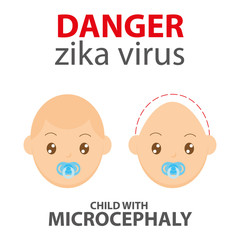 Zika Virus