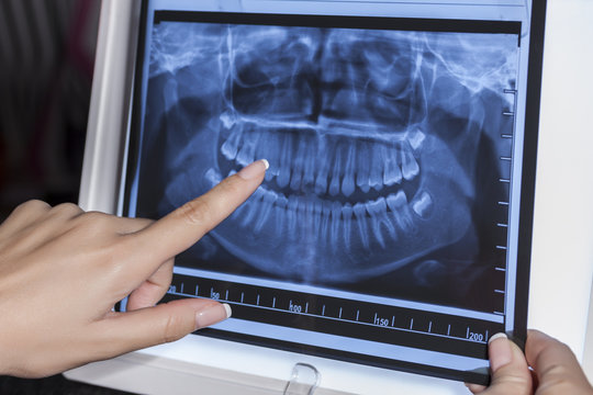 Holding Dental X-Ray