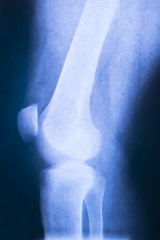 Knee x-ray.

X-ray health care image.
