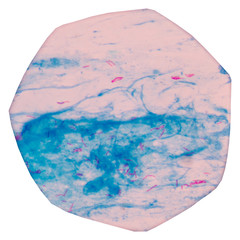 Red AFB cells on blue background.