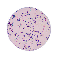 Blue gram positive cocci on white background.
