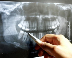 dental X-Ray study