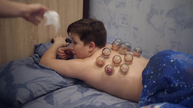The boy treated medical vacuum cups on his back, he lies on the bed, he shed snot and he blows his nose into a tissue

