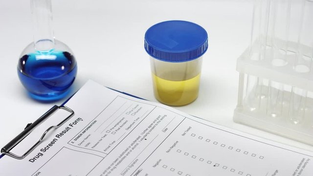 Close up of hand in blue glove put urine collection container with sample on table near the drug test result form on clipboard