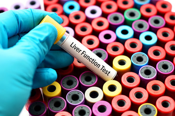 Fototapeta premium Blood for liver function test