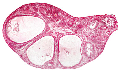 Light micrograph of ovary showing primordial, primary and secondary follicles. Light microscopy, hematoxylin and eosin stain, magnification 200x. Colors are enhanced for better visualisation
