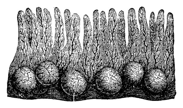 Peyer's Patch, vintage engraving