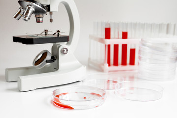 blood in glass tubes, petri dish on background of microscope