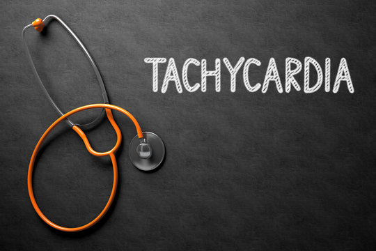 Tachycardia Concept on Chalkboard. 3D Illustration.