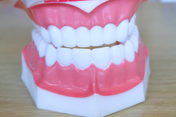 Model teeth whitening. Dental care.