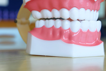 Model teeth whitening. Dental care.