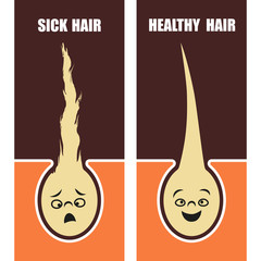 Medical Educational poster, sick and healthy hair. Vector illustration.