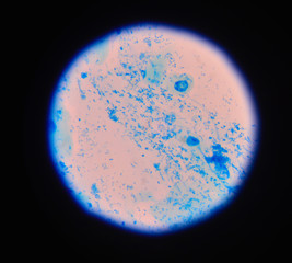 Gram staining, also called Gram's method, is a method of differe