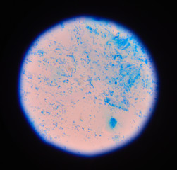 Gram staining, also called Gram's method, is a method of differe