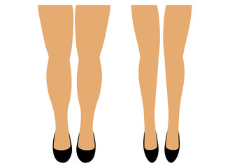 Obraz premium Women's legs two pairs of thin and full vector illustration