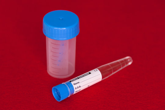 Analisi cliniche. Provetta. Contenitore