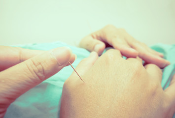 Vintage style photo of selective focused asian man is receiving Acupuncture treatment