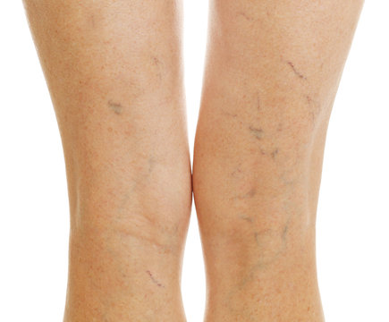 Female legs on white background, closeup