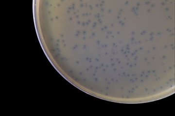 Bacteriophage plaques (clear zone) within the lawn bacterial aga
