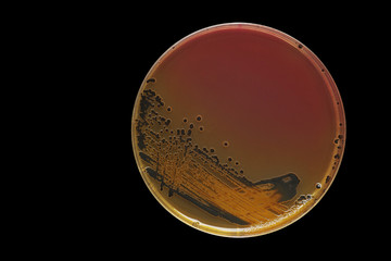 Black bacterial colonies of Salmonella species on Salmonella Shi