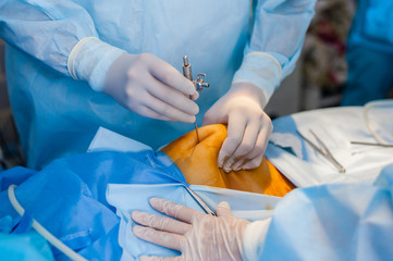 The operation using the endoscope in gynecology