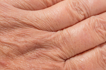 Texture of the skin with wrinkles on the body of mature male