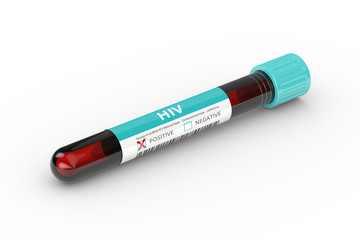 3D rendering of test tube with  HIV virus blood sample